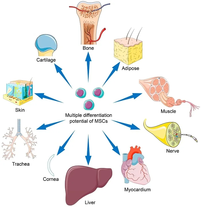 Diferencia entre MCS y MSCS