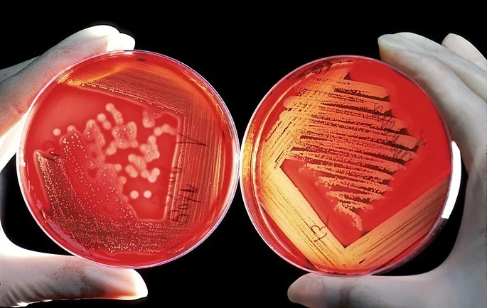 Diferencia entre colonias bacterianas y fúngicas