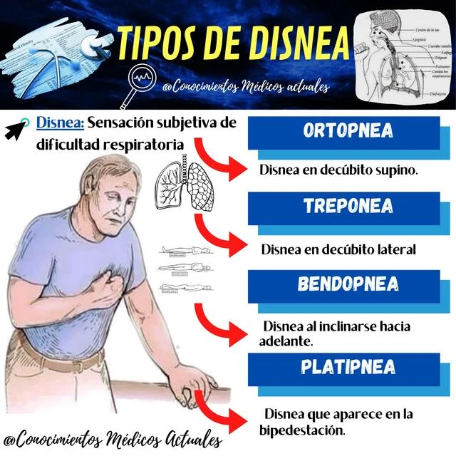 Diferencia entre disnea y ortopnea