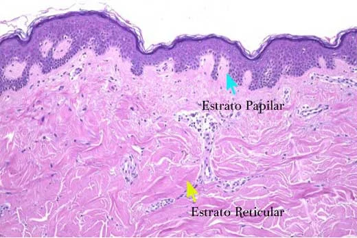 Diferencia entre la dermis papilar y la reticular