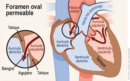 Diferencia entre fosa y foramen