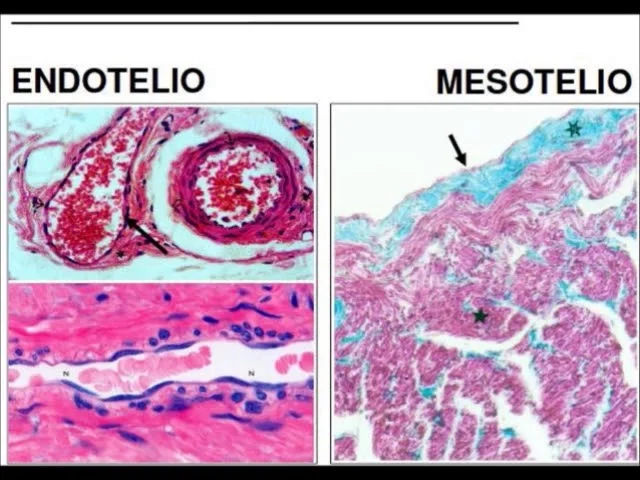 Diferencia entre mesotelio y endotelio