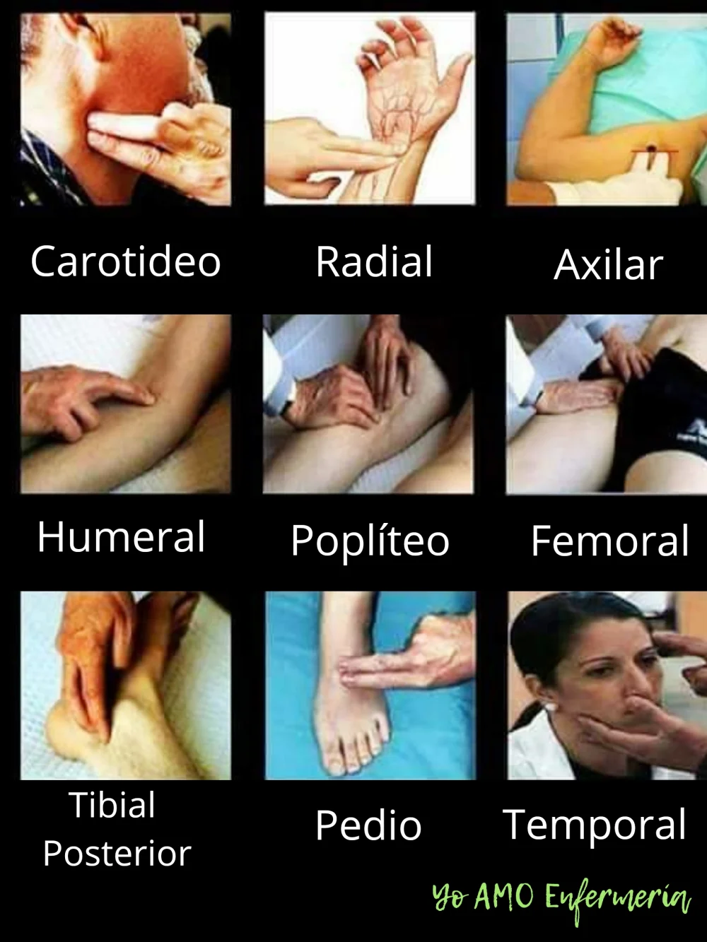 Diferencia entre pulso apical y radial