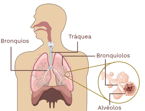 Diferencia entre bronquios y bronquiolos