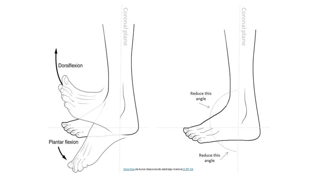 Diferencia entre dorsiflexión y flexión plantar