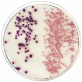 Diferencia entre E. coli y coliformes