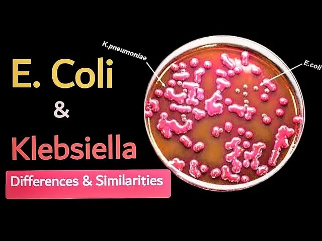 Diferencia entre E. coli y Klebsiella pneumoniae