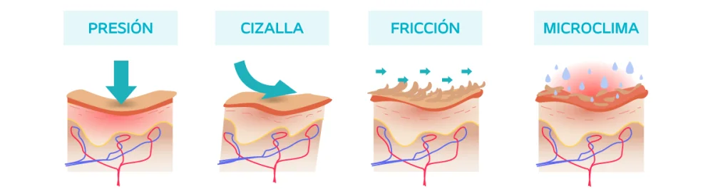 Diferencia entre fricción y cizallamiento