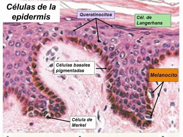 Diferencia entre queratinocitos y melanocitos