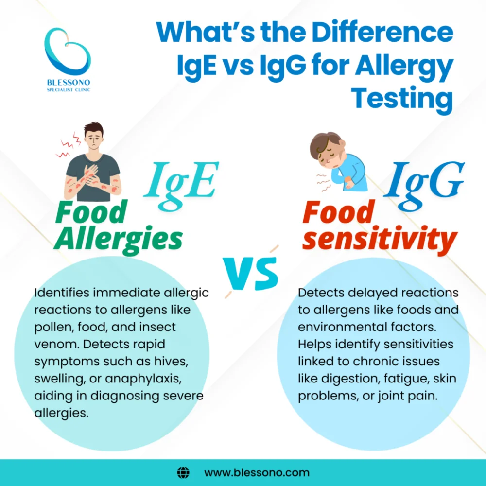 Diferencia entre IgE e IgG