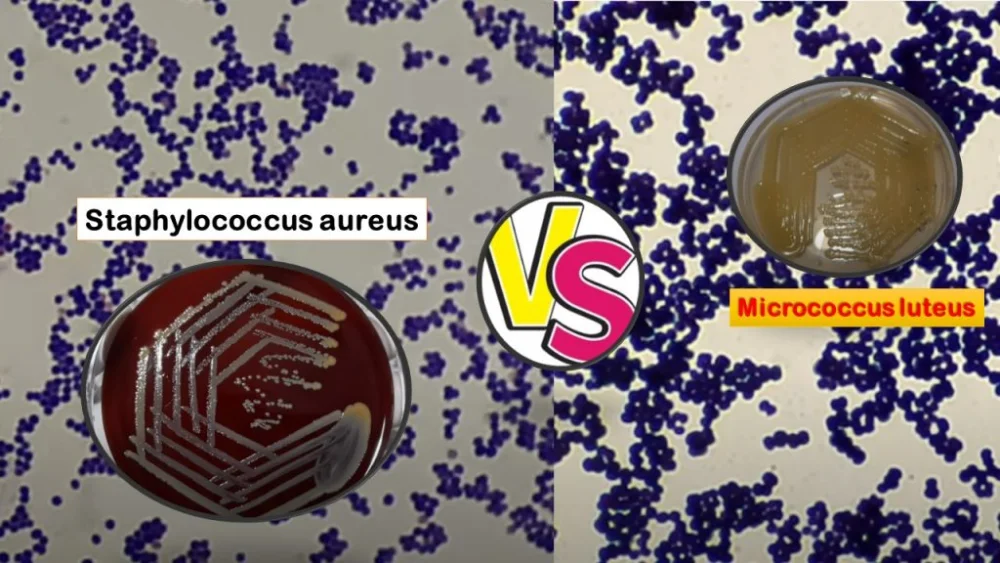 Diferencia entre Micrococcus y Staphylococcus