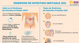 Diferencia entre EII y SII