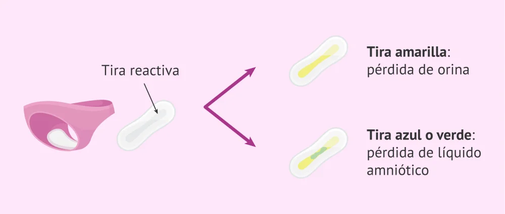Diferencia entre el líquido amniótico y la orina