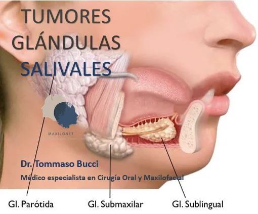 Diferencia entre la glándula salival y el ganglio linfático