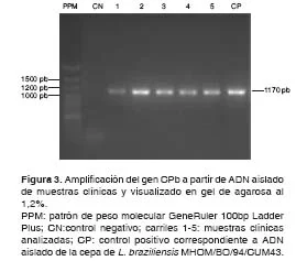 Diferencia entre RAPD y RFLP