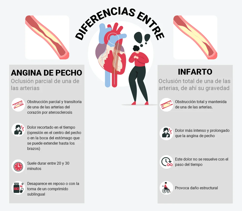 Diferencia entre angina e isquemia