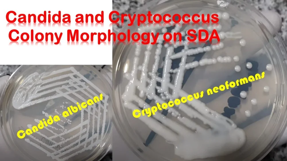 Diferencia entre Candida y Cryptococcus
