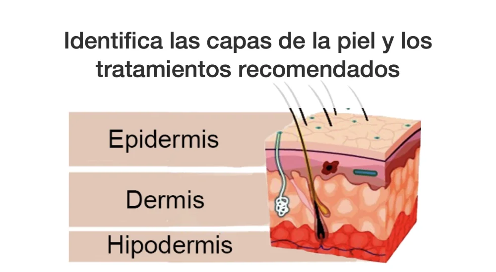 Diferencia entre epidermis e hipodermis