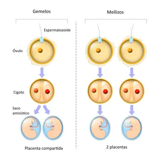 Diferencia entre gemelos maternos y paternos