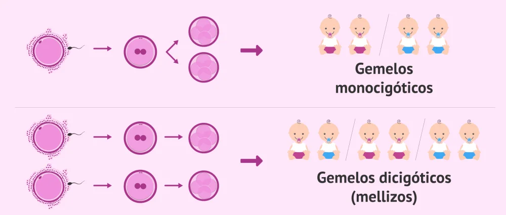 Diferencia entre gemelos monocigóticos y dicigóticos