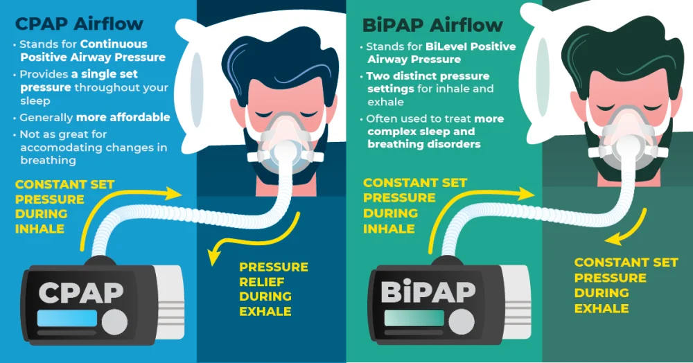 Diferencia entre CPAP y BIPAP