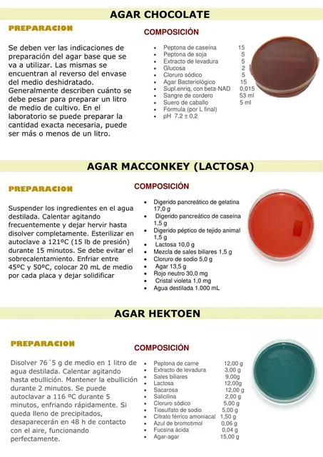 Diferencia entre el agar sangre y el agar chocolate