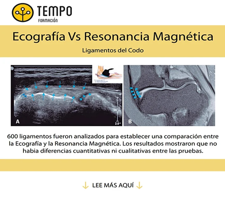 Diferencia entre resonancia magnética y ultrasonido
