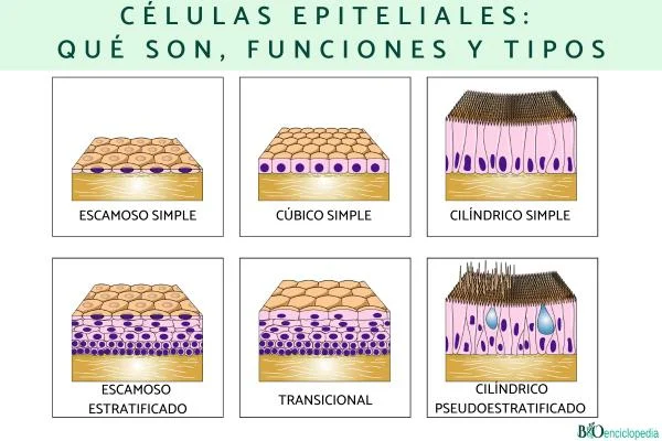 Diferencia entre célula epitelial ciliada y célula epitelial escamosa