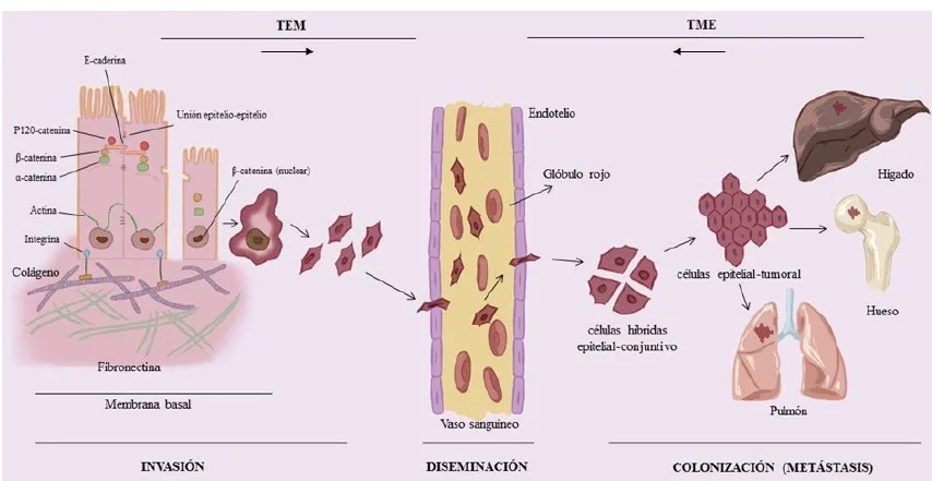 Diferencia entre células epiteliales y mesenquimales