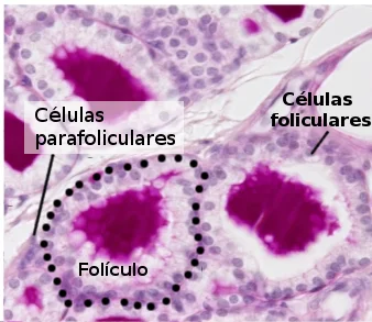 Diferencia entre células foliculares y parafoliculares
