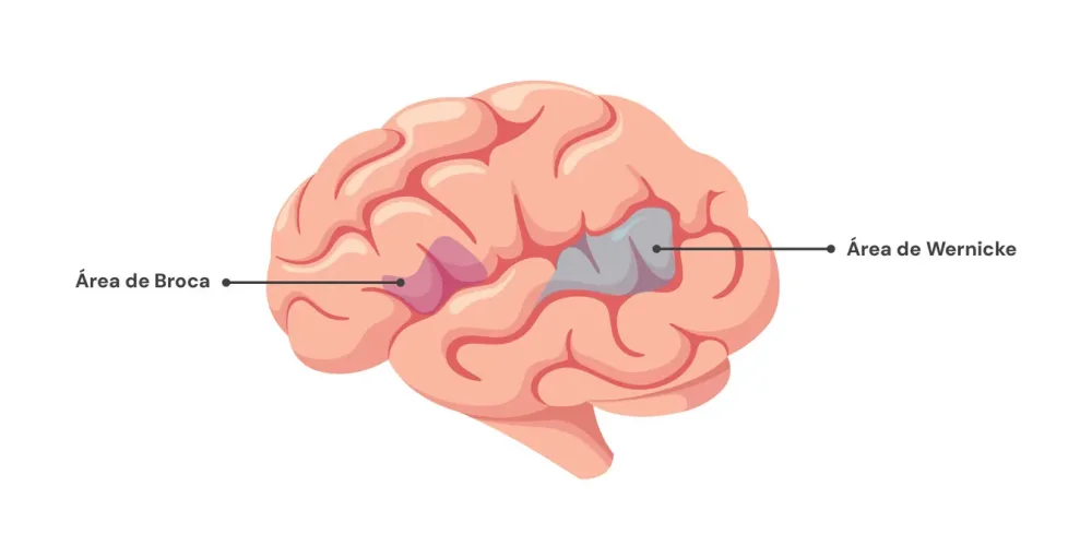 Diferencia entre el área de Broca y el área de Wernicke