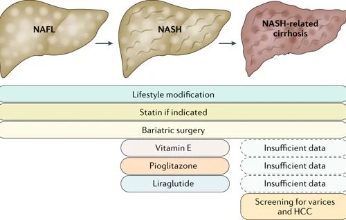 Diferencia entre NASH y NAFLD
