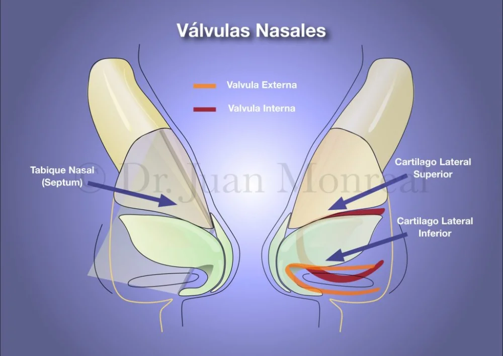 Diferencia entre válvulas y tabique