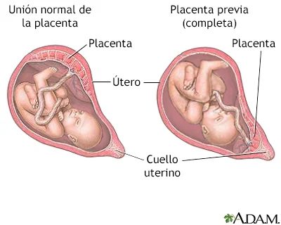 Diferencia entre la placenta y el útero