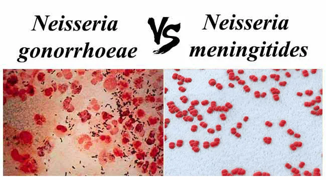 Diferencia entre Neisseria gonorrhoeae y Neisseria meningitidis