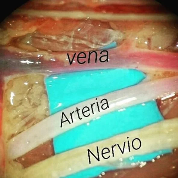 Diferencia entre nervio y vena