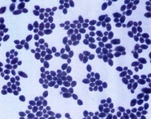 Diferencia entre Saccharomyces cerevisiae y Saccharomyces boulardii