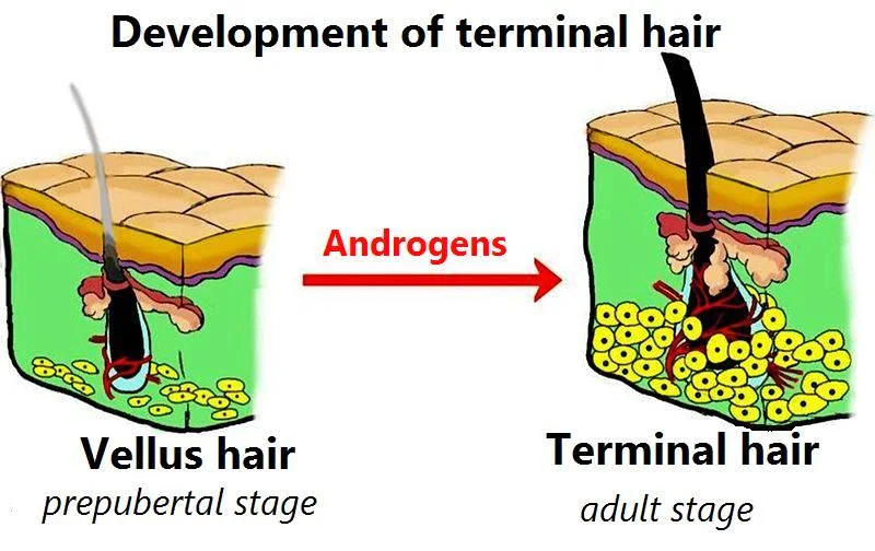 Diferencia entre vello y pelo terminal