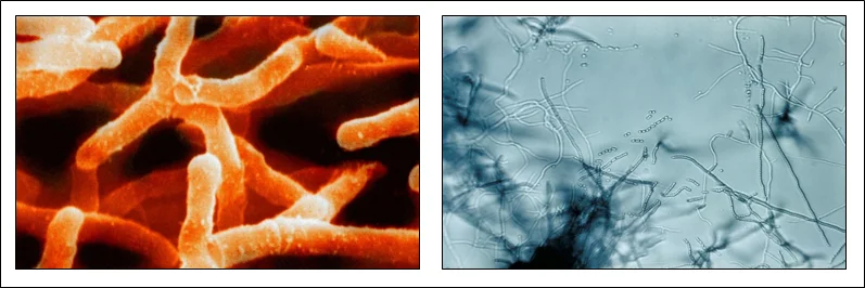 Diferencia entre actinomicetos y bacterias Ciencia