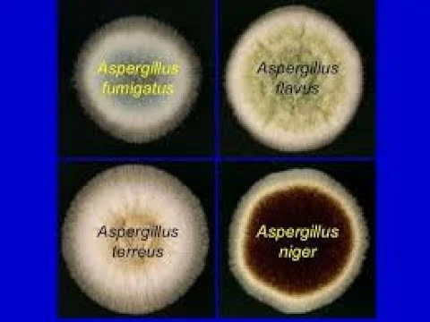 Diferencia entre Aspergillus Niger y Aspergillus flavus