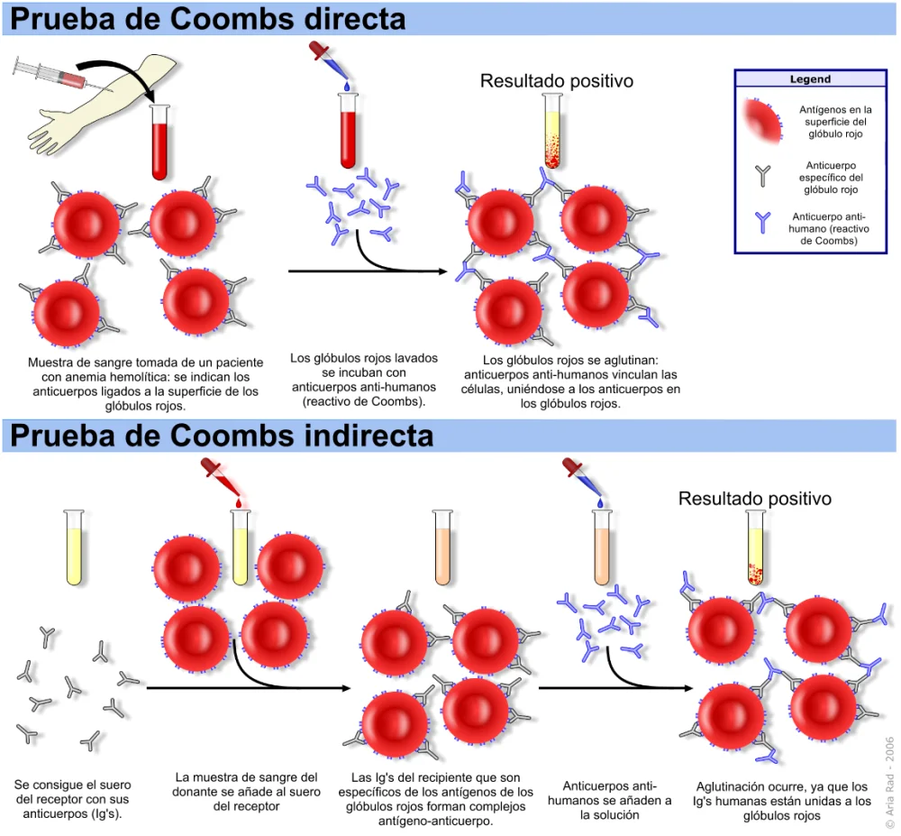 Diferencia entre la prueba de Coombs directa e indirecta