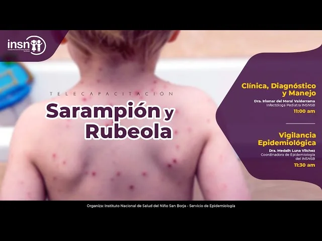 Diferencia entre el sarampión y la rubéola