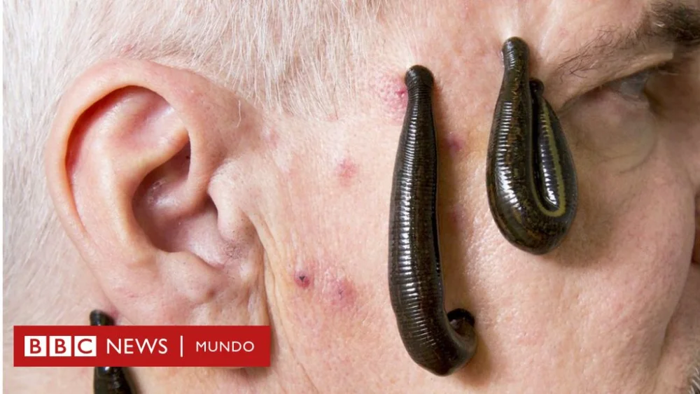 Diferencia entre sanguijuelas y chupasangres