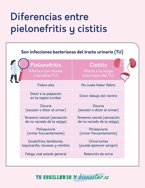 Diferencia entre cistitis y pielonefritis