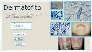 Diferencia entre dermatofitos y no dermatofitos