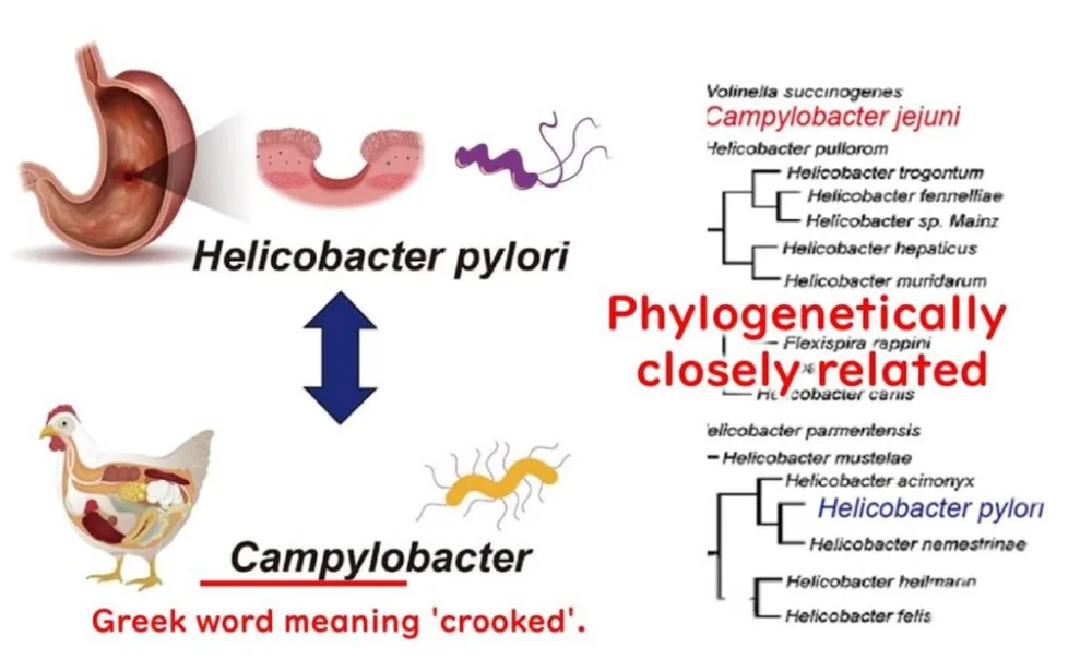 Diferencia entre Helicobacter Pylori y Campylobacter Jejuni