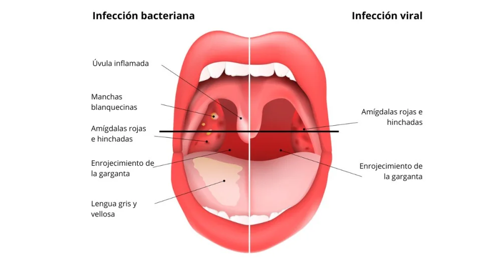 Diferencia entre la amígdala izquierda y la derecha