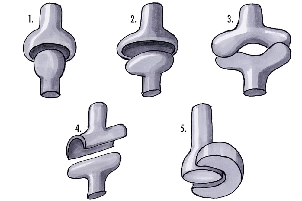 Diferencia entre la articulación condiloide y la articulación en silla de montar