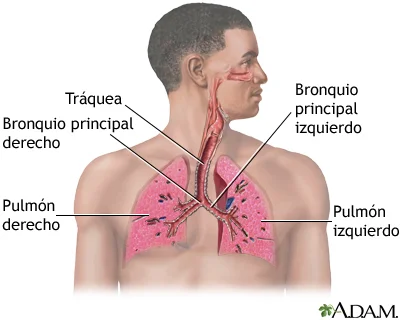 ¿Qué son las enfermedades pulmonares?