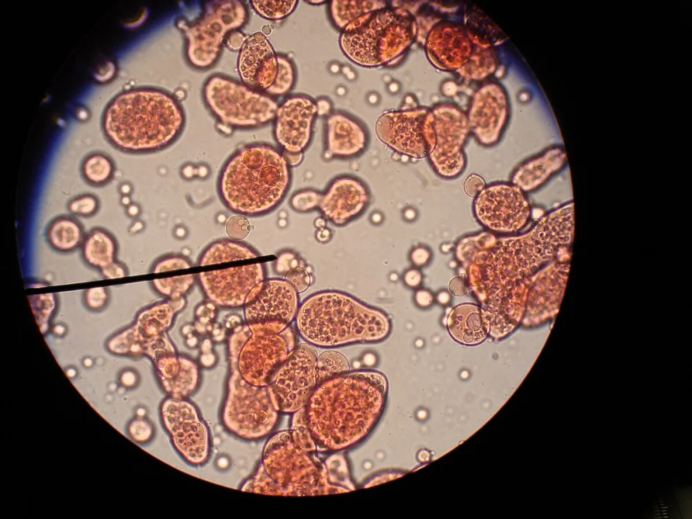 Diferencia entre coacervado y microesfera